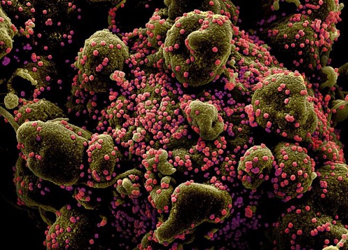 Virus corona: Cộng sinh với dơi "ít nhất hơn 10.000 năm" và lí do cần sinh vật trung gian để lây sang người