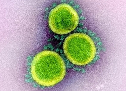 Tìm ra điểm yếu trong lớp màng của coronavirus