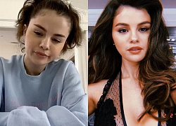 Selena Gomez tàn phai nhan sắc, bệnh tật vì yêu nhầm người