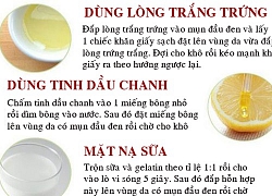 Những mẹo loại sạch mụn đầu đen trên mũi ngay tại nhà, không thử chỉ có tiếc