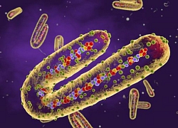 Điểm danh những virus đáng sợ trên Trái Đất