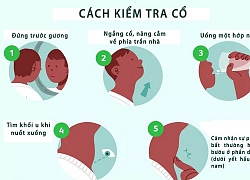 Cách tự kiểm tra tuyến giáp