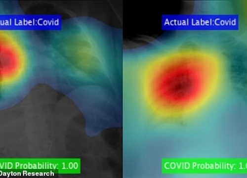 Áp dụng trí tuệ nhân tạo vào việc phát hiện Covid-19 nhanh chóng và chính xác