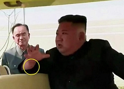 Vết đỏ gây đồn đoán trên cổ tay Kim Jong-un ngày tái xuất