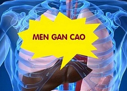 Bị tăng men gan, phải làm sao?