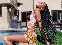 Winnie Harlow diện bikini thả dáng quyến rũ bên bể bơi