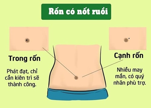 3 nốt ruồi vùng rốn quý như "kim cương" hút tài lộc, ai có được sướng trọn một đời