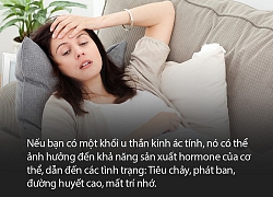 Ung thư thần kinh - nghe tưởng là u não nhưng thật ra có thể khởi phát ở bất kỳ bộ phận nào trên cơ thể, bạn phải xem chừng