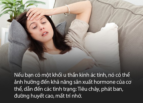 Ung thư thần kinh - nghe tưởng là u não nhưng thật ra có thể khởi phát ở bất kỳ bộ phận nào trên cơ thể, bạn phải xem chừng