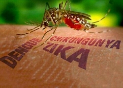 Virus Zika gây nguy hiểm như thế nào khi truyền từ mẹ sang con?