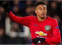 Lingard tham vấn 2 đàn anh, rời M.U sang Serie A?