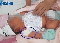 TP. HCM: Bé gái có dấu hiệu bất thường ở vai sau khi sinh tại Bệnh viện Quận 9