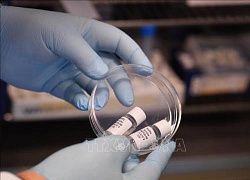 Chính phủ Anh tài trợ thử nghiệm vaccine ngừa virus SARS-CoV-2 trên người