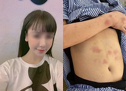 Lời kể của cô gái bị gã thanh niên đánh suốt 2 tiếng vì từ chối tình cảm