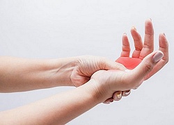 Thành công trong việc can thiệp tắc mạch để phẫu thuật loại bỏ bướu máu