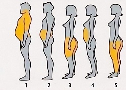 Vị trí béo tiết lộ lý do tích mỡ của bạn