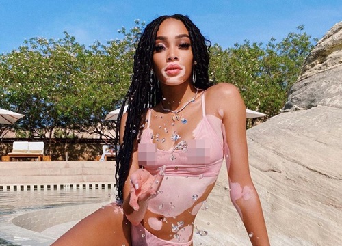 Winnie Harlow thư giãn bên hồ bơi với bikini nhỏ xíu