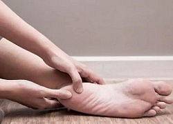 6 cách giảm đau gót chân tại nhà hiệu quả