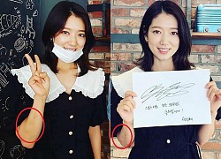 Park Shin Hye gầy đi trông thấy, tay xuất hiện nhiều vết bầm tím