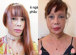 Cô dâu 62 tuổi tuyên bố 'Chết cũng làm con ma đẹp', quyết tâm đi trùng tu vòng 1