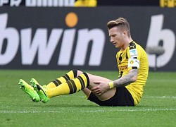 Reus dính chấn thương lần thứ 9 từ đầu mùa giải 2019/20