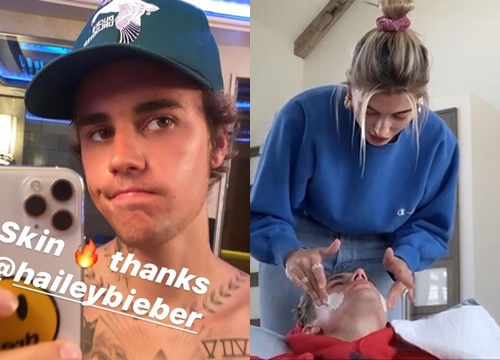 Justin Bieber khoe làn da căng bóng, khỏe mạnh nhờ được Hailey điều trị mụn trong thời gian cách ly