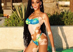 Winnie Harlow thả dáng chuẩn như tạc tượng