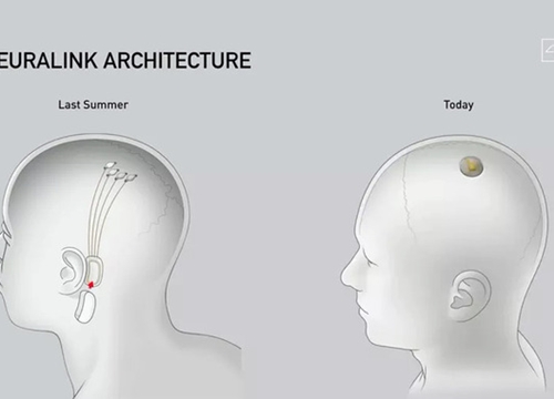 Công ty Elon Musk cấy hệ thống kết nối não cho lợn