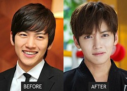 Netizen Hàn bối rối khi so sánh ảnh trước và sau phẫu thuật mũi của Ji Chang Wook