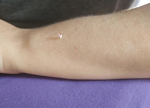 Chú mèo bị gãy răng khi cạp tay bạn gái của "sen" làm dân mạng cười bò