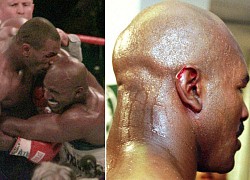 Sợ bị cắn, Roy Jones tính mua bảo hiểm tai trước trận gặp Mike Tyson