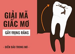 Ngủ mơ bị gãy răng, chảy máu có phải là điềm xui?