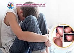 Trẻ hẹp bao quy đầu, khi nào nên nong?