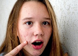 Ăn nhiều đường nhanh già, dễ béo: Xem bảng thống kê sau để áng chừng lượng đường của các loại đồ uống phổ biến