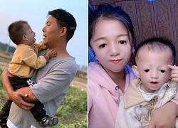 Cô gái mặt "mỏ chim" lấy chồng khỏe mạnh, đẻ con ai cũng tò mò xem mặt rồi lắc đầu