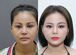 Lê Giang &#8220;dao kéo&#8221; 20 lần riêng chiếc mũi làm 7 lần mới vừa ý