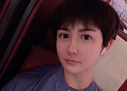 "Nam thần" Lưu Tử Thần chia sẻ về đau khổ khi bị biến chứng thẩm mỹ