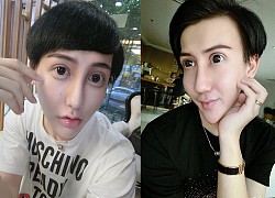 Xuất hiện trở lại sau 3 tháng mất tích, &#8220;chàng trai mặt rắn&#8221; tiết lộ muốn chết ngay vì biến chứng hậu 50 lần dao kéo