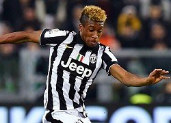 Juventus bị chỉ trích vì thiếu kiên nhẫn với Kingsley Coman