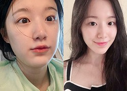 Nữ idol thế hệ mới sáng ra đã khoe mặt sưng vù không make up, dân tình tôn luôn thành "thánh mặt mộc", bỏ quên cả Suzy