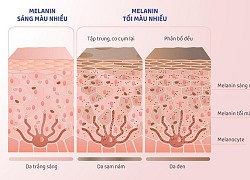 Để có làn da trắng khỏe từ bên trong, cần tấn công đúng "kẻ thù"