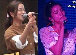 Dân tình hốt hoảng khi soi ra hạch sưng to bất thường ở cổ Jisoo (BLACKPINK), nghi bệnh cũ năm ngoái giờ lại tái phát