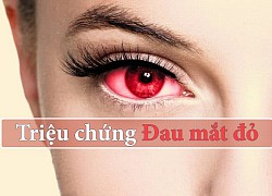 Khó chịu với đau mắt đỏ