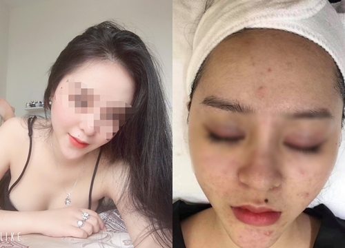 Sốc: Lộ nhan sắc thật lúc chưa makeup của Sugarbaby: "Mặt đầy mụn, nghi vấn từng bán dâm"