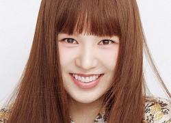 Wendy (Red Velvet) xuất hiện lạ lẫm trên bìa tạp chí hậu chấn thương