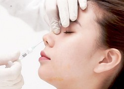 Mê tiêm filler giá rẻ, nhiều chị em đối mặt hậu quả rùng mình