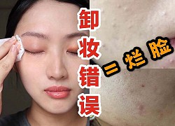 Beauty blogger người Nhật cảnh báo: Chị em đang &#8220;huỷ hoại&#8221; chính làn da của mình ngay từ bước tẩy trang