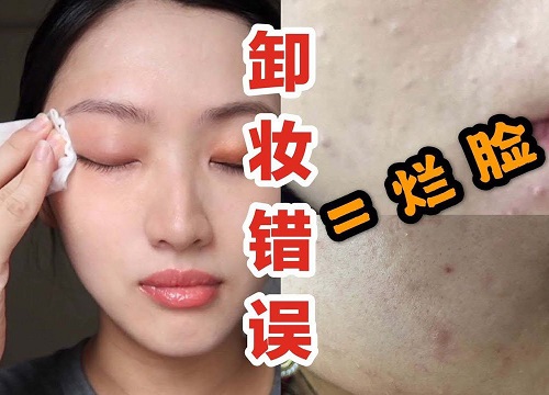 Beauty blogger người Nhật cảnh báo: Chị em đang "huỷ hoại" chính làn da của mình ngay từ bước tẩy trang