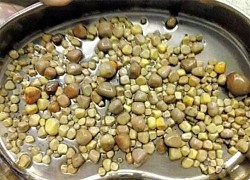 Người đàn ông có cả trăm viên sỏi thận vì thói quen ăn khuya
