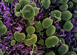 Ấn Độ phân lập và nuôi cấy thành công biến thể mới của virus SARS-CoV-2